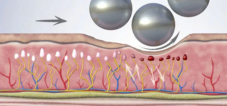 Pain relief through massage and compression microvibration.