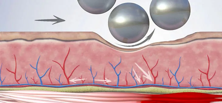 Muscle toning and stimulation of their activity during procedures.