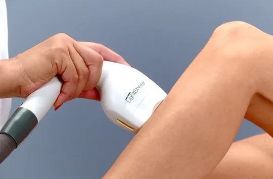 Процедура лазерної епіляції LightSheer DESIRE® на нозі клієнта.
