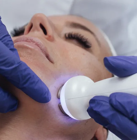 Electroporation procedure with LED for delivering active ingredients into the skin.