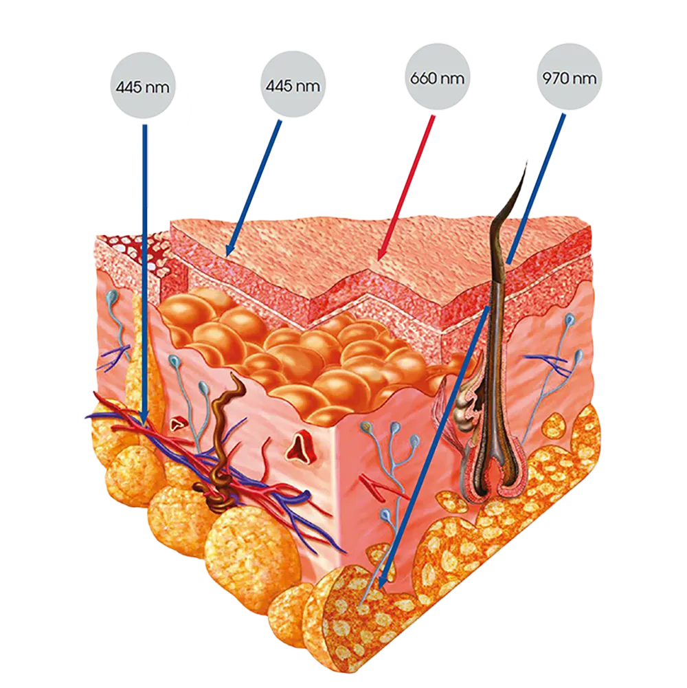 Healthy skin after a procedure using the K-Laser Blue Derma laser for photo-rejuvenation and pigmentation treatment.